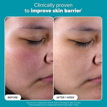 Paula’s Choice – Skin Perfecting BHA Liquid Exfoliant 30ml (Korean Version)