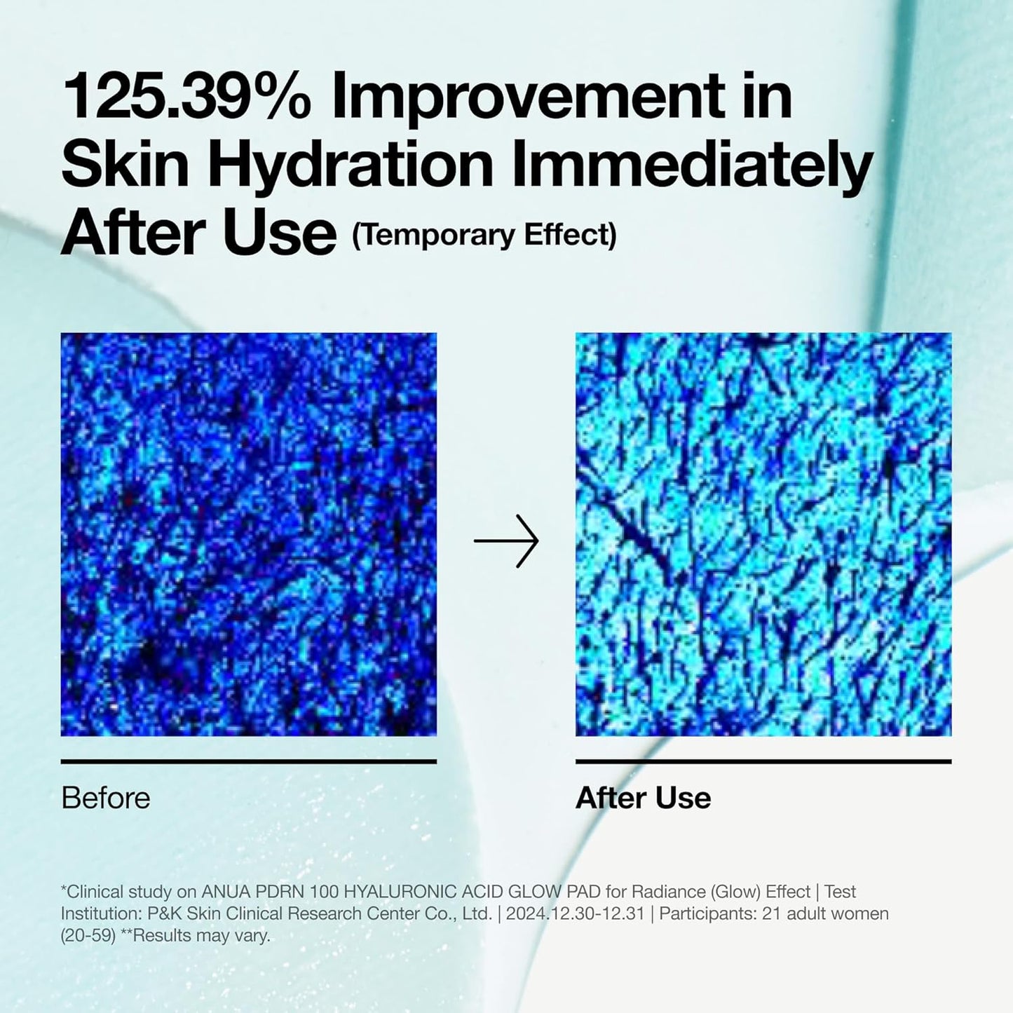 Anua – Glow Pad PDRN+Hyaluron Pad 60ea 180ml