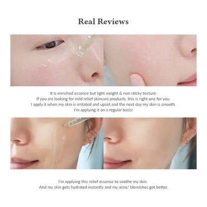 Dr.Althea – Skin Relief Essence 30 ml