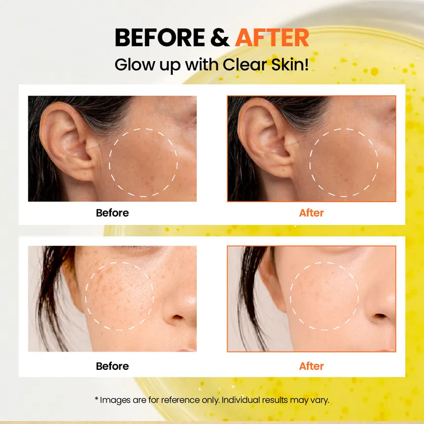 K-Secret – Seoul 1988 Capsule Serum: Niacinamide 5%+Yuja 30ml