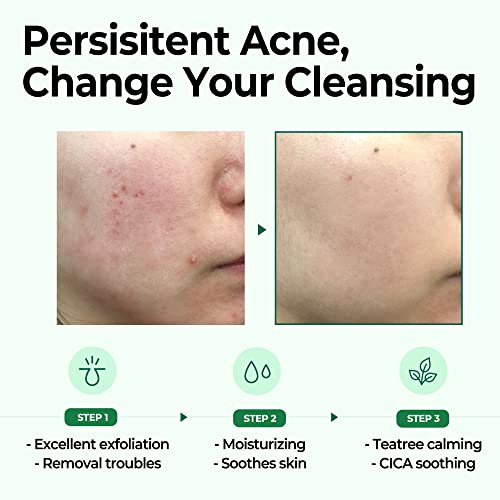 Some By Mi - AHA BHA PHA 30 Days Miracle Cleansing Bar 30g Mini
