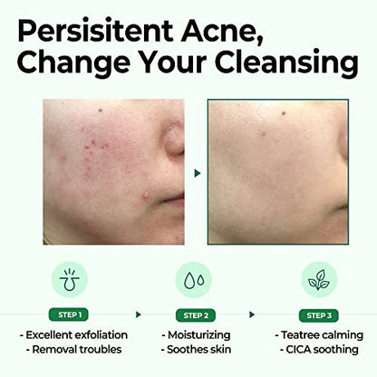 Some By Mi - AHA BHA PHA 30 Days Miracle Cleansing Bar 30g Mini