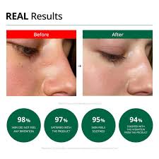 Dr.G – Red Blemish Clear Soothing Cream 10ml