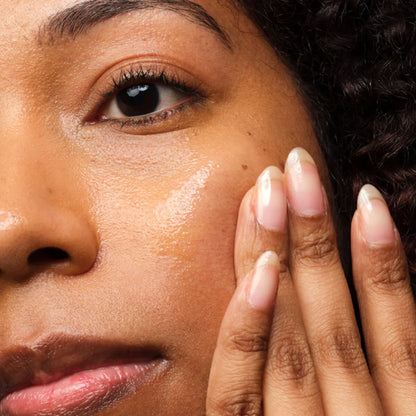The Ordinary - Niacinamide 10% + Zinc 1 % 30ml